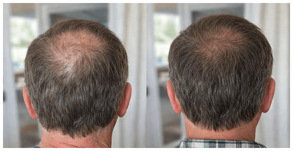 Antes e Depois 1